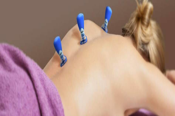 cupping-therapy-in-chennai